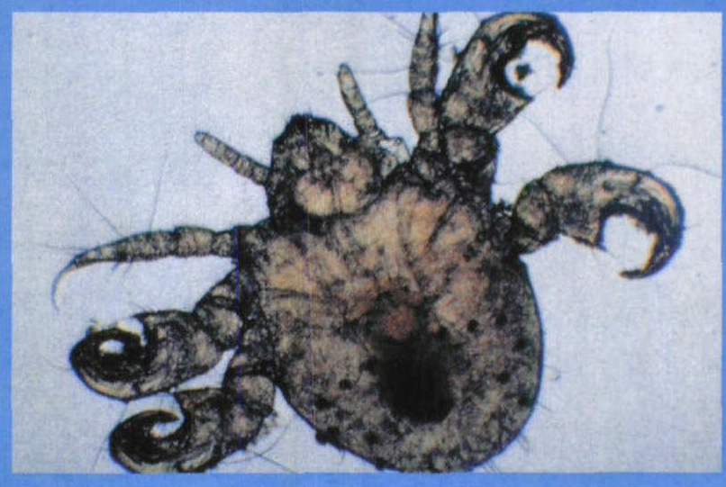 陰虱病